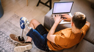 High angle view of man with prosthetic leg sitting on floor at home and using laptop on sunny day